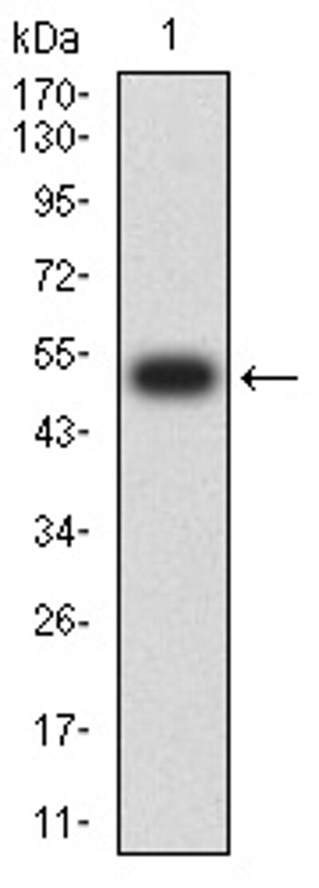 TOP2A Antibody in Western Blot (WB)