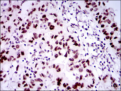 53BP1 Antibody in Immunohistochemistry (Paraffin) (IHC (P))