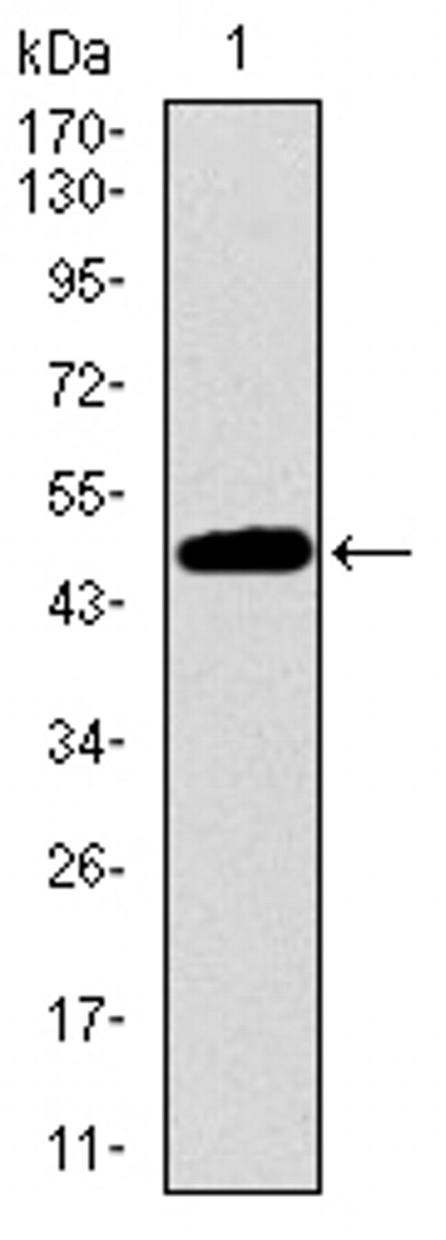 53BP1 Antibody in Western Blot (WB)