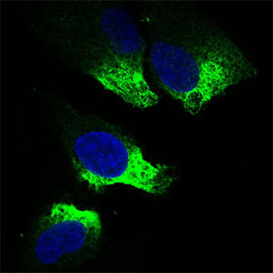 TWIST1 Antibody in Immunocytochemistry (ICC/IF)