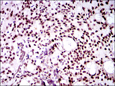 TWIST1 Antibody in Immunohistochemistry (Paraffin) (IHC (P))