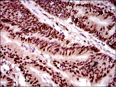 TWIST1 Antibody in Immunohistochemistry (Paraffin) (IHC (P))