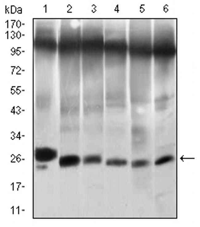 TWIST1 Antibody in Western Blot (WB)