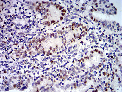 UFD1L Antibody in Immunohistochemistry (Paraffin) (IHC (P))