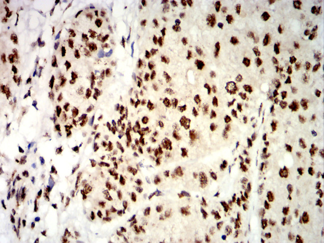 UHRF1 Antibody in Immunohistochemistry (Paraffin) (IHC (P))