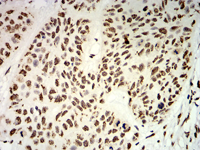 UHRF1 Antibody in Immunohistochemistry (Paraffin) (IHC (P))