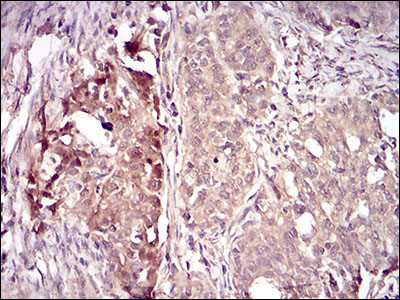 Villin Antibody in Immunohistochemistry (Paraffin) (IHC (P))