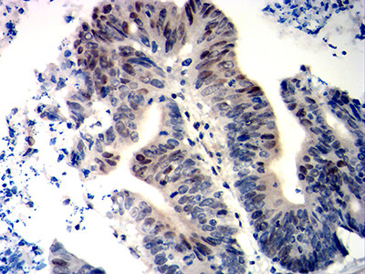 WT1 Antibody in Immunohistochemistry (Paraffin) (IHC (P))