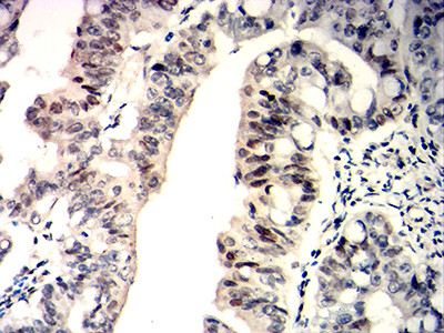 WT1 Antibody in Immunohistochemistry (Paraffin) (IHC (P))