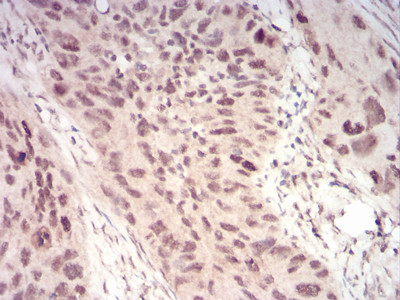 WTAP Antibody in Immunohistochemistry (Paraffin) (IHC (P))