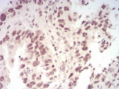 WTAP Antibody in Immunohistochemistry (Paraffin) (IHC (P))