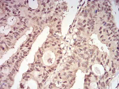 14-3-3 beta Antibody in Immunohistochemistry (Paraffin) (IHC (P))