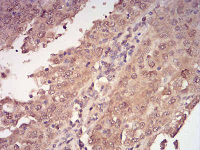 14-3-3 beta Antibody in Immunohistochemistry (Paraffin) (IHC (P))