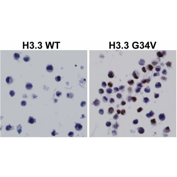 H3.3 G34V oncohistone mutant Antibody in Immunocytochemistry (ICC/IF)