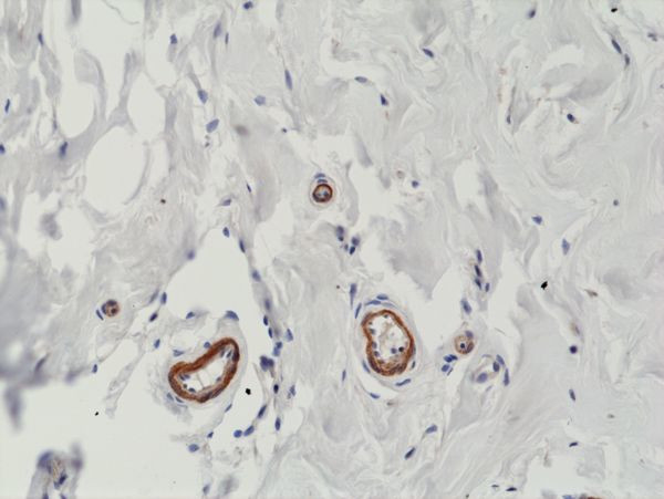 VEGF Antibody in Immunohistochemistry (Paraffin) (IHC (P))