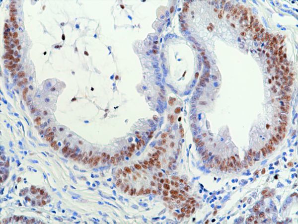 RNASEH2B Antibody in Immunohistochemistry (Paraffin) (IHC (P))