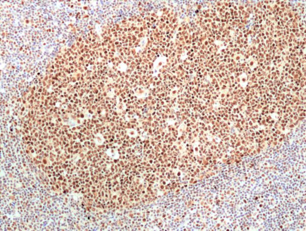 RNASEH2B Antibody in Immunohistochemistry (Paraffin) (IHC (P))