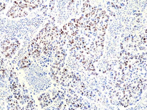 RNASEH2B Antibody in Immunohistochemistry (Paraffin) (IHC (P))