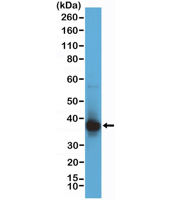 RNASEH2B Antibody in Western Blot (WB)