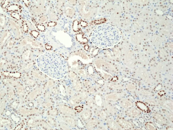 PAX8 Antibody in Immunohistochemistry (Paraffin) (IHC (P))