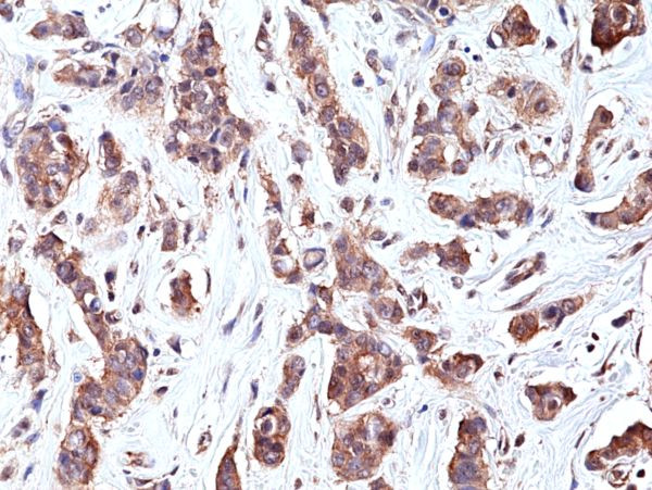 p70 S6 Kinase Antibody in Immunohistochemistry (Paraffin) (IHC (P))