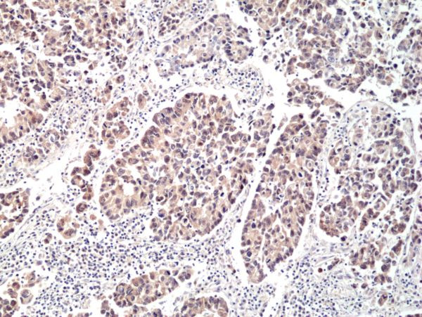 p70 S6 Kinase Antibody in Immunohistochemistry (Paraffin) (IHC (P))