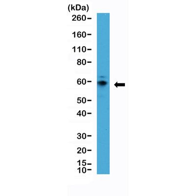 p70 S6 Kinase Antibody in Western Blot (WB)