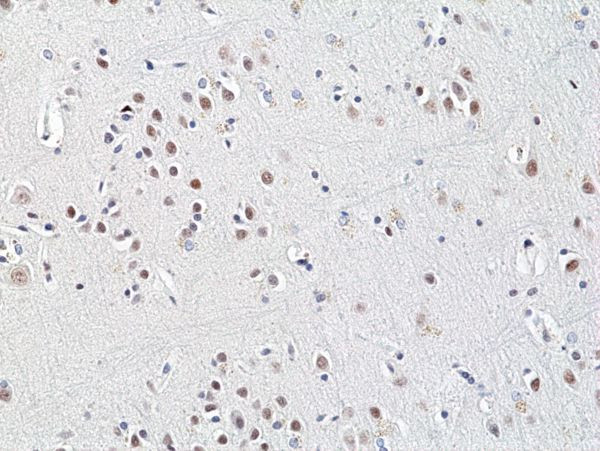 HDAC3 Antibody in Immunohistochemistry (Paraffin) (IHC (P))