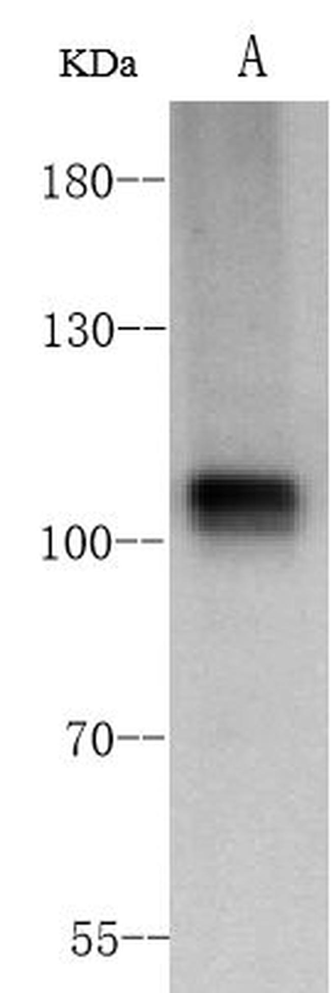 ACE2 Antibody in Western Blot (WB)