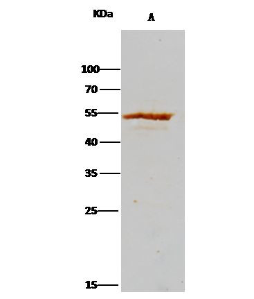 ADSL Antibody in Immunoprecipitation (IP)