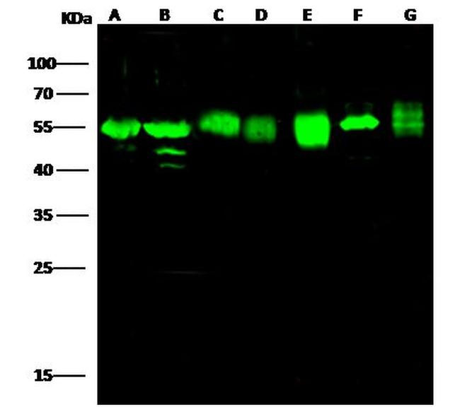 ADSL Antibody in Western Blot (WB)