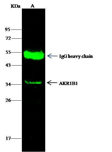 AKR1B1 Antibody in Immunoprecipitation (IP)