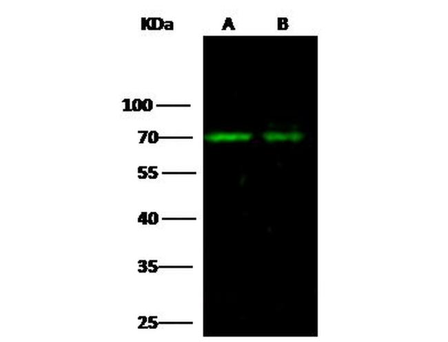 Angiopoietin 2 Antibody in Western Blot (WB)