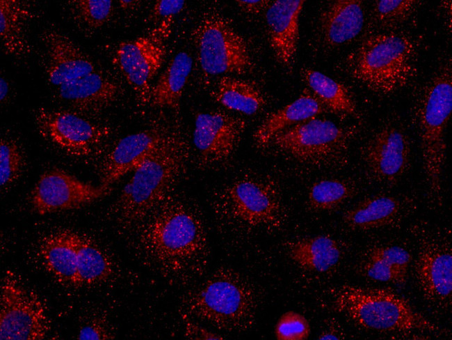 Angiopoietin 2 Antibody in Immunocytochemistry (ICC/IF)