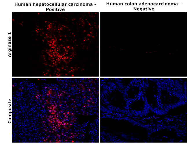 Arginase 1 Antibody in Immunohistochemistry (Paraffin) (IHC (P))