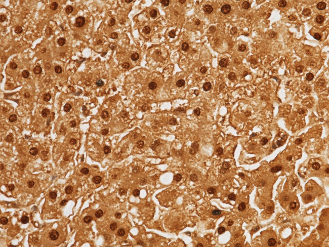 Arginase 1 Antibody in Immunohistochemistry (Paraffin) (IHC (P))