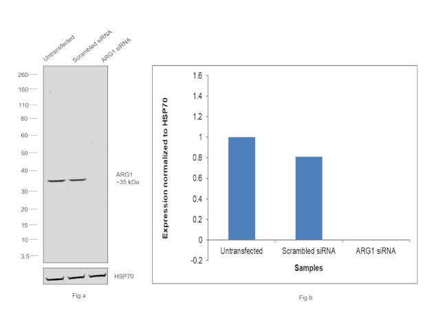 Arginase 1 Antibody