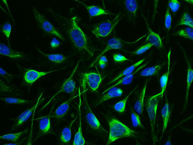 Arginase 1 Antibody in Immunocytochemistry (ICC/IF)