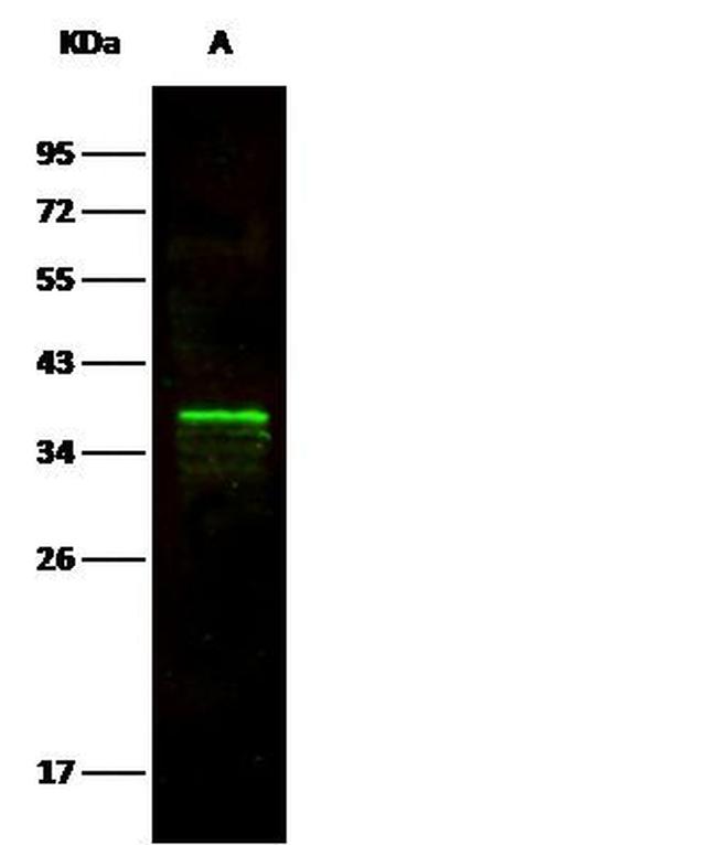 Arginase 1 Antibody in Western Blot (WB)