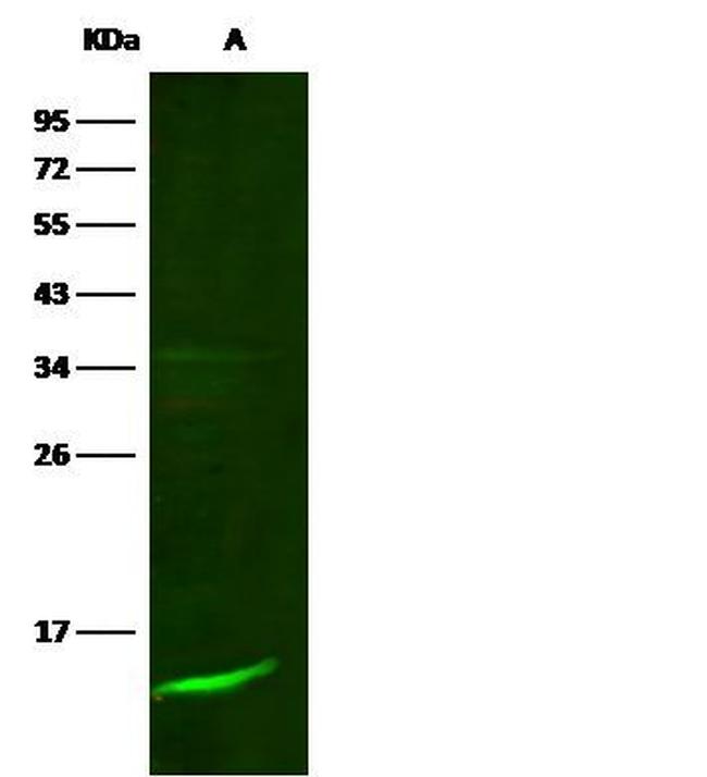 beta-2 Microglobulin Antibody in Western Blot (WB)