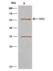 Carboxypeptidase M Antibody in Immunoprecipitation (IP)