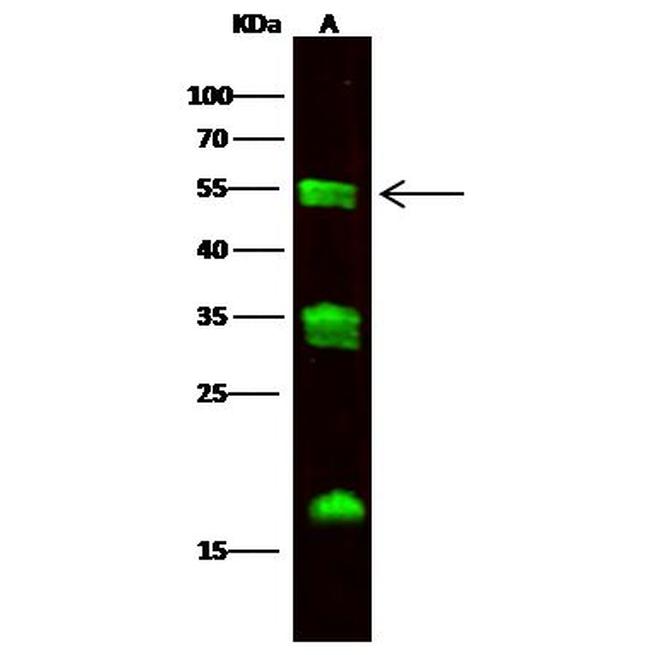 Carboxypeptidase M Antibody in Western Blot (WB)