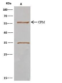 Carboxypeptidase M Antibody in Immunoprecipitation (IP)