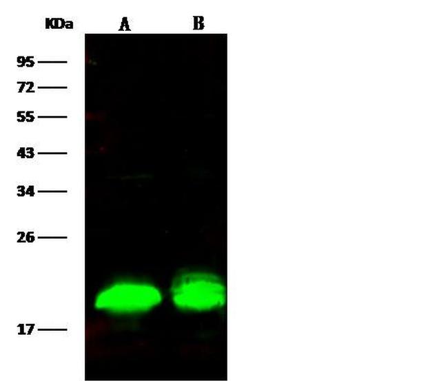 4EBP1 Antibody in Western Blot (WB)