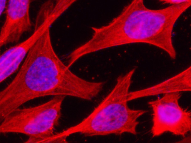 HSP70 Antibody in Immunocytochemistry (ICC/IF)