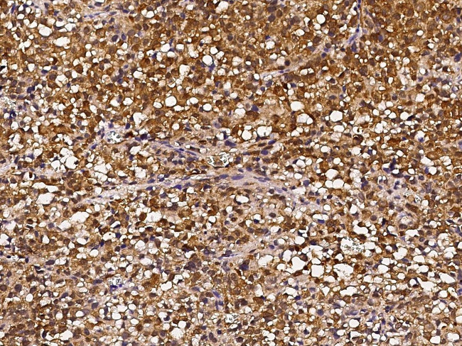 HSP70 Antibody in Immunohistochemistry (Paraffin) (IHC (P))