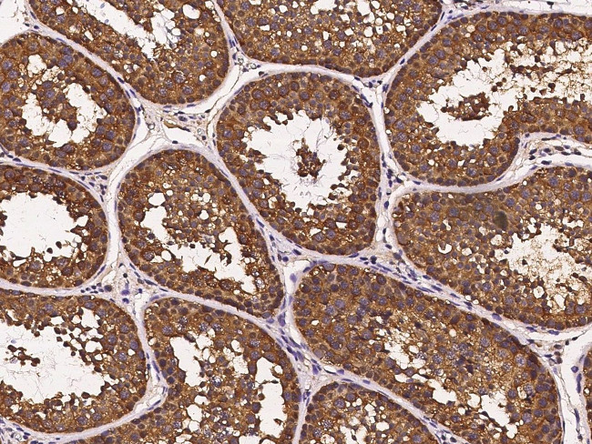 HSP70 Antibody in Immunohistochemistry (Paraffin) (IHC (P))