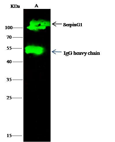 C1 inhibitor Antibody in Immunoprecipitation (IP)