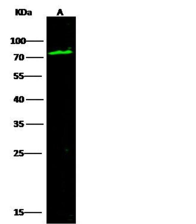 C1 inhibitor Antibody in Western Blot (WB)