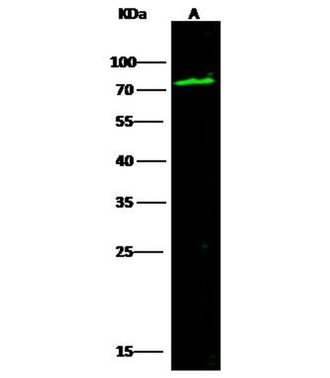 C1 inhibitor Antibody in Western Blot (WB)